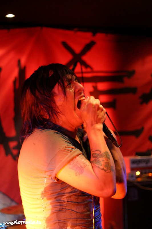 The Casualties
