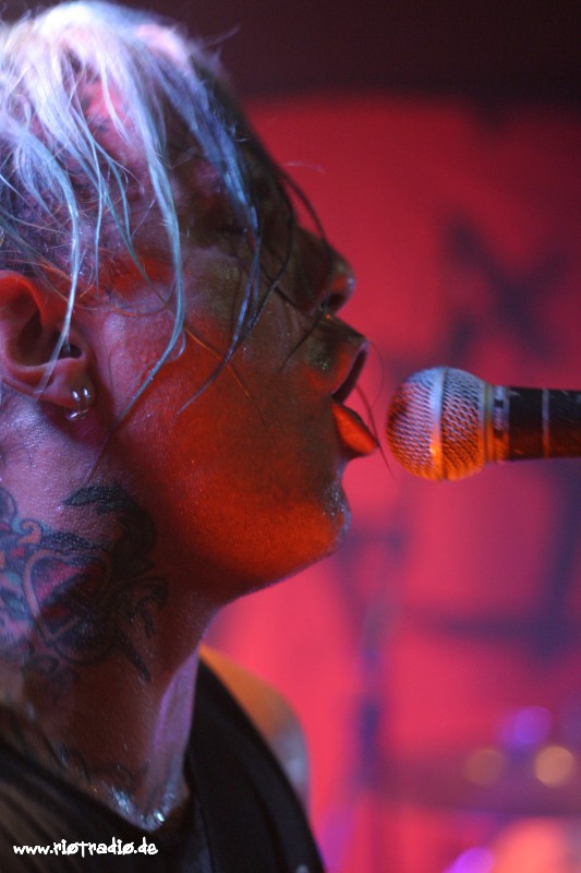 The Casualties